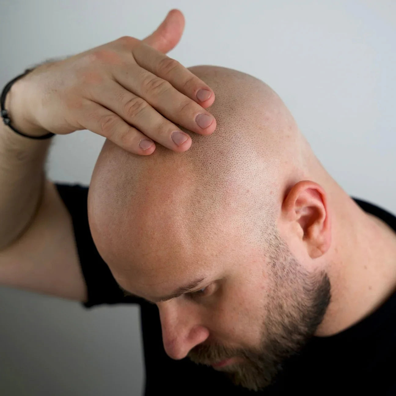 Better Be Bold Anti-Pigment Bald Serum (0-6mm)